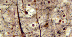 Nanopositioning Microscopy Stages