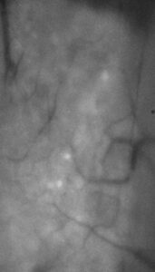 GCaMP6f fluorescence in trigeminal ganglion without OP800