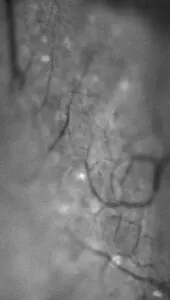 GCaMP6f fluorescence in the trigeminal ganglion with OP800